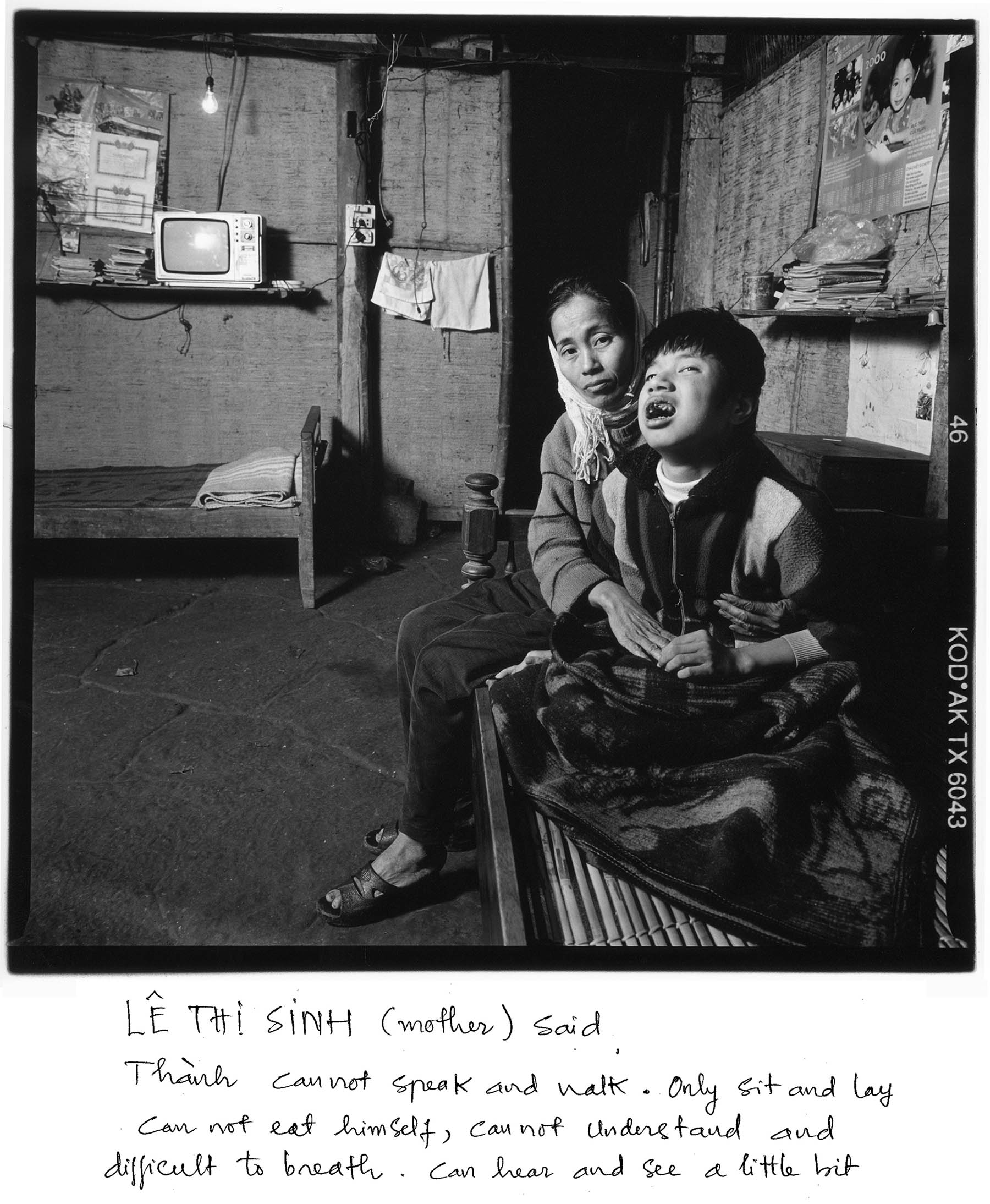 Cam Lo district (Quang Tri province) just south of the former North-South border is one of the heavily sprayed areas.
Dao Duy Thanh (boy, 12) is a possible victim. Mother Le Thi Sinh (39): "Thanh can't speak and walk, only sit and lie down. He can't eat by himself, can't understand (people) and has difficulty in breathing. He can hear and see a little."
They live in Cam Thuy commune (Cam Lo). Sinh says her husband was in the N-Vietnamese army for 5 years. He died in 1998 of blood cancer.