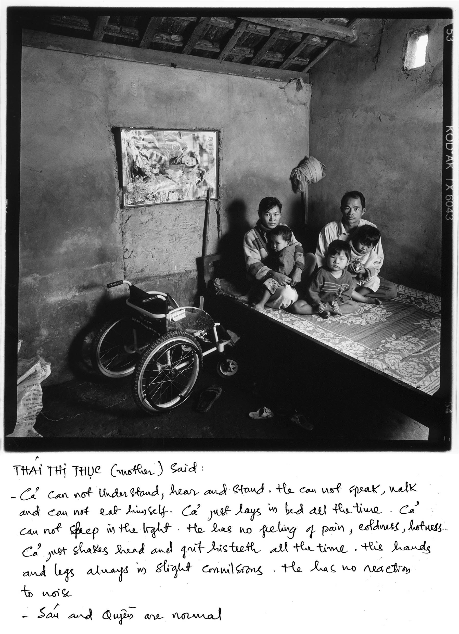 Cam Lo district (Quang Tri province) just south of the former North-South border is one of the heavily sprayed areas. 
Tran Dinh Ca (boy, 6, centre) is a possible victim. The other 2 children of farmers Tran Dinh Hieu (father, 30) and Thai Thi Thuc (mother, 28) - Tran Thi Sau (girl, 5, right) and Tran Dinh Quyen (boy, 3, left) are OK. The mother: "Ca can't understand, speak, hear nor walk or stand. He can't eat by himself. He just lies in bed all the time. Ca has no feeling of pain, or cold and heat. He just shales his head and grinds his teeth all the time. He doesn't react to noise, and his hands and legs are always in slight convulsions." They live in Cam Hieu commune (Cam Lo).