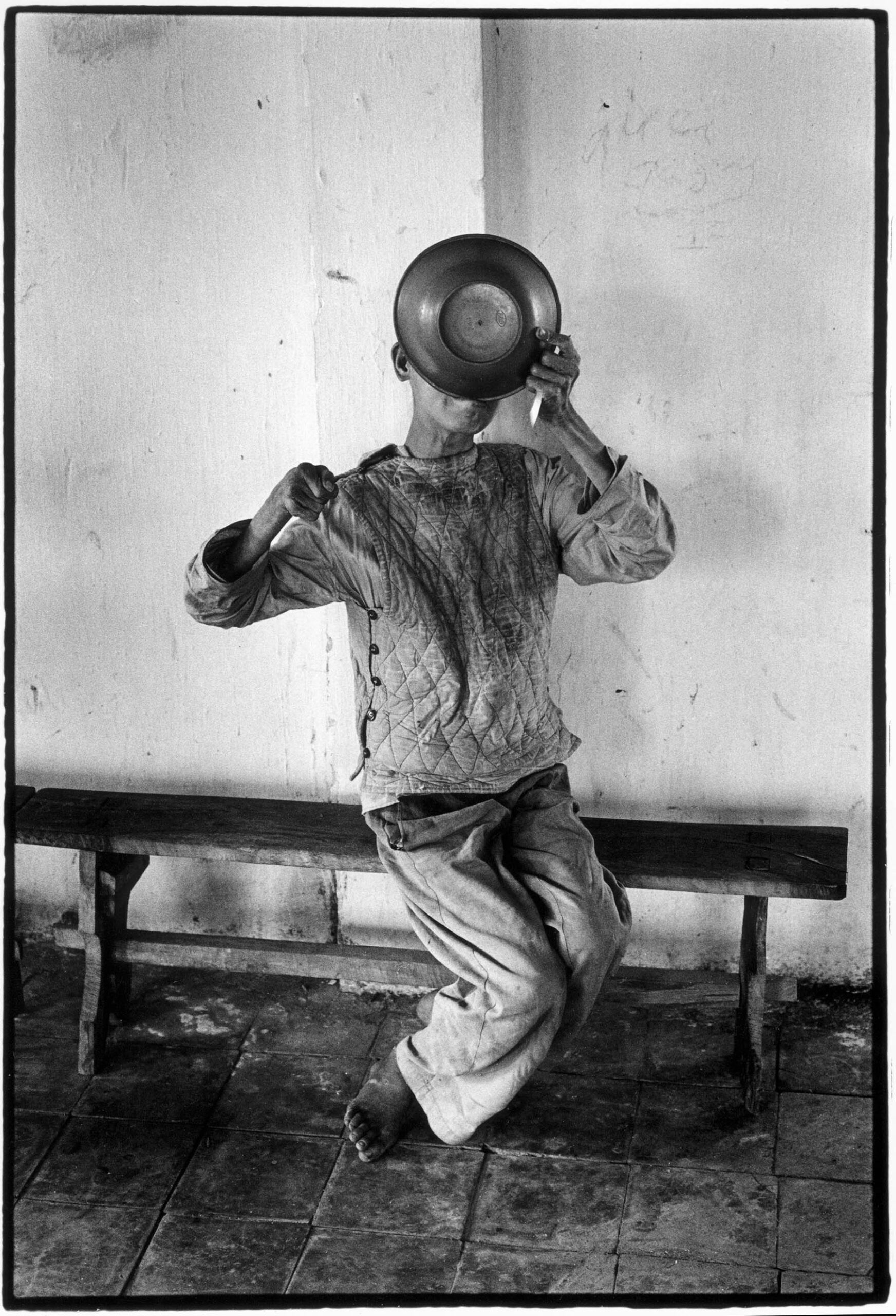 Vietnam, psychiatry and war.  Patient - a traumatized former soldier - at the "Center for Mental Treatment" in Ba Vi town to the West of Hanoi. Part of the patients are suffering from war traumas.