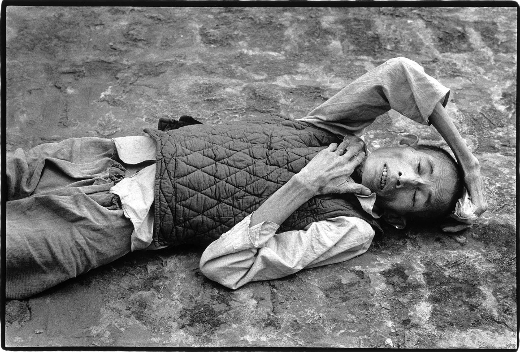 Vietnam, psychiatry and war.  Patient - a traumatized former soldier - at the "Center for Mental Treatment" in Ba Vi town. Part of the patients are suffering from war traumas.